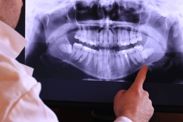 Best Emergency Denture Repair in Bellevue, PA